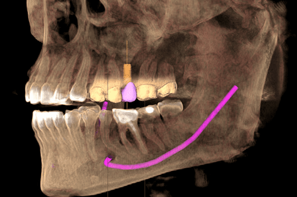 dental cone beam computed tomography 1 1